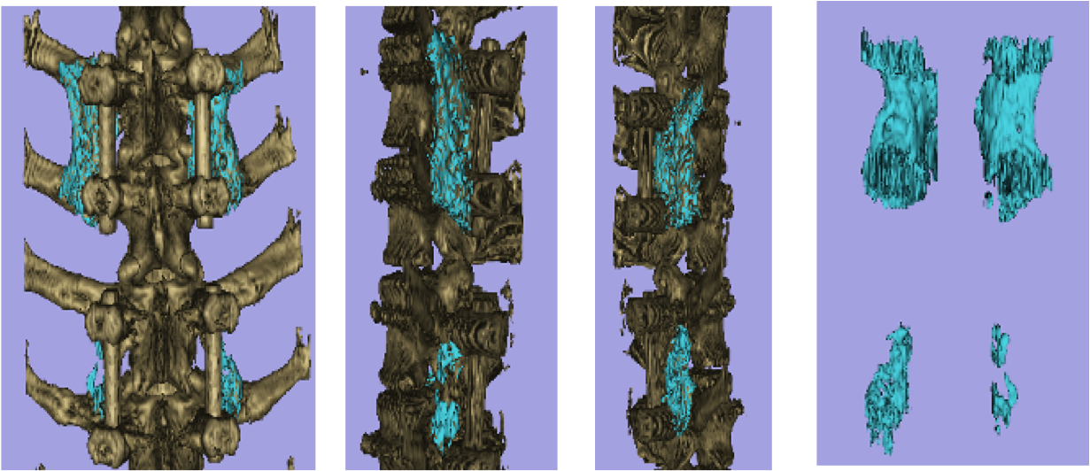 CT Modeling Orthopedic Research Laboratory